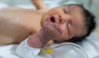 Suriye’de deprem sonrası enkazda doğan Eye bebek anne ve babasız büyüyecek